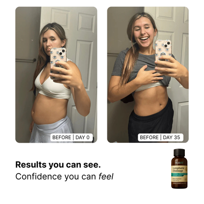 Lymphatic Drainage Drops